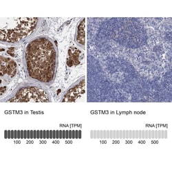 GSTM3 Antibody, Novus Biologicals:Antibodies:Primary Antibodies