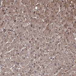 GSTO1 Antibody, Novus Biologicals 0.1mL; Unlabeled:Antibodies, Polyclonal