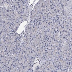 GSTO1 Antibody, Novus Biologicals 0.1mL; Unlabeled:Antibodies, Polyclonal