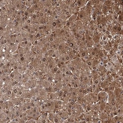 GSTO1 Antibody, Novus Biologicals 0.1mL; Unlabeled:Antibodies, Polyclonal