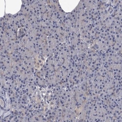 GSTO1 Antibody, Novus Biologicals 0.1mL; Unlabeled:Antibodies, Polyclonal