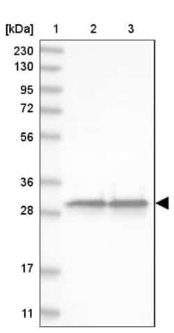 GSTO1 Antibody, Novus Biologicals 0.1mL; Unlabeled:Antibodies, Polyclonal