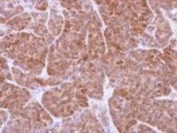 GSTT1 Antibody, Novus Biologicals 0.1mg; Unlabeled:Antibodies, Polyclonal
