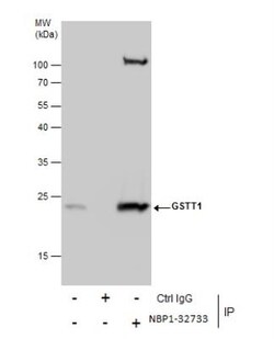 GSTT1 Antibody, Novus Biologicals 0.1mg; Unlabeled:Antibodies, Polyclonal