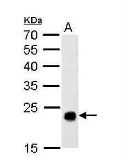 GSTT1 Antibody, Novus Biologicals 0.1mg; Unlabeled:Antibodies, Polyclonal