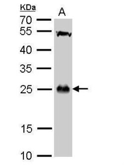 GSTT1 Antibody, Novus Biologicals 0.1mg; Unlabeled:Antibodies, Polyclonal
