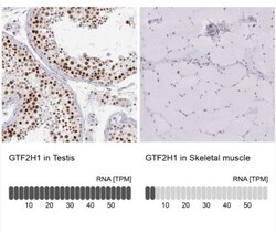 GTF2H1 Antibody, Novus Biologicals:Antibodies:Primary Antibodies