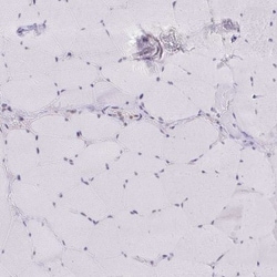 GTF2H1 Antibody, Novus Biologicals:Antibodies:Primary Antibodies