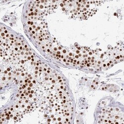 GTF2H1 Antibody, Novus Biologicals:Antibodies:Primary Antibodies