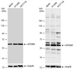 GTF2H1 Antibody, Novus Biologicals 0.1mL; Unlabeled:Antibodies, Polyclonal