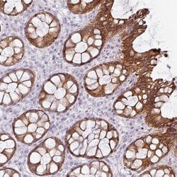GTF2H3 Antibody, Novus Biologicals 0.1mL; Unlabeled:Antibodies, Polyclonal
