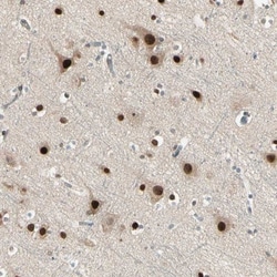 GTF3A Antibody, Novus Biologicals 0.1mL; Unlabeled:Antibodies, Polyclonal