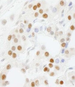 GTF3C5 Antibody, Novus Biologicals 0.1mL; Unlabeled:Antibodies, Polyclonal