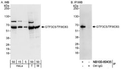 GTF3C5 Antibody, Novus Biologicals 0.1mL; Unlabeled:Antibodies, Polyclonal