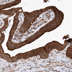 GTP binding protein era homolog Antibody, Novus Biologicals 25 &mu;L; Unlabeled:Antibodies,