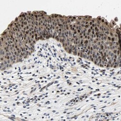 GTPBP10 Antibody, Novus Biologicals 0.1mL; Unlabeled:Antibodies, Polyclonal