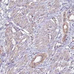 GTSE1 Antibody, Novus Biologicals 0.1mL; Unlabeled:Antibodies, Polyclonal