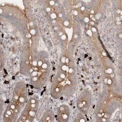 GUCY2C Antibody, Novus Biologicals 0.1mL; Unlabeled:Antibodies, Polyclonal
