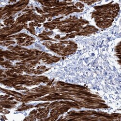 GULP1/CED-6 Antibody, Novus Biologicals 25 &mu;L; Unlabeled:Antibodies,