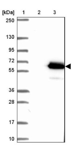 Gabpb2 Antibody, Novus Biologicals 25ul | Buy Online | Novus Biologicals | Fisher Scientific