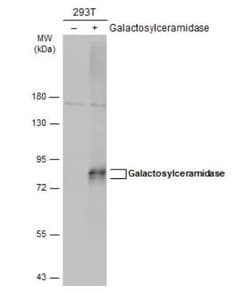Galactosylceramidase/GALC Antibody, Novus Biologicals 0.1 mL | Buy Online | Novus Biologicals | Fisher Scientific