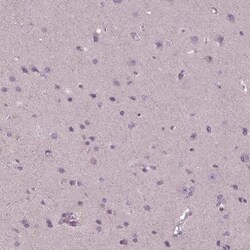 Galanin Antibody, Novus Biologicals:Antibodies:Primary Antibodies