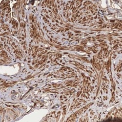 Galectin-1 Antibody, Novus Biologicals:Antibodies:Primary Antibodies