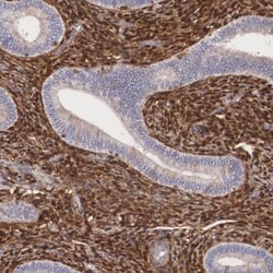 Galectin-1 Antibody, Novus Biologicals:Antibodies:Primary Antibodies