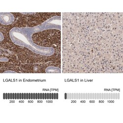 Galectin-1 Antibody, Novus Biologicals:Antibodies:Primary Antibodies