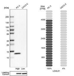 Galectin-1 Antibody, Novus Biologicals:Antibodies:Primary Antibodies