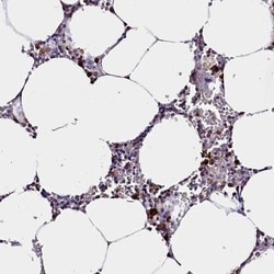 Galectin-10 Antibody, Novus Biologicals 0.1mL; Unlabeled:Anticuerpos