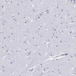 Galectin-10 Antibody, Novus Biologicals 0.1mL; Unlabeled:Anticuerpos