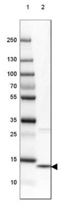 Galectin-10 Antibody, Novus Biologicals 0.1mL; Unlabeled:Anticuerpos