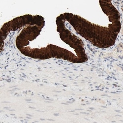 Galectin-2 Antibody, Novus Biologicals 0.1mL; Unlabeled:Antibodies, Polyclonal