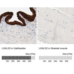 Galectin-2 Antibody, Novus Biologicals 0.1mL; Unlabeled:Antibodies, Polyclonal