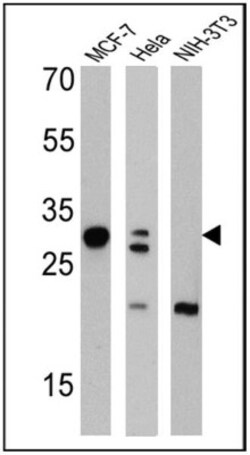 Galectin-3 Antibody (A3A12) - BSA Free, Novus Biologicals 0.1mg; Unlabeled:Antibodies,