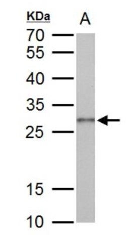 Galectin-3 Antibody, Novus Biologicals 0.1mL; Unlabeled:Antibodies, Polyclonal