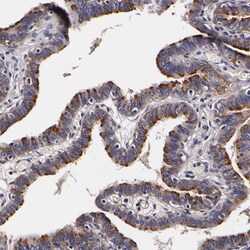Galectin-3BP/MAC-2BP/LGALS3BP Antibody, Novus Biologicals 0.1mL; Unlabeled:Antibodies,