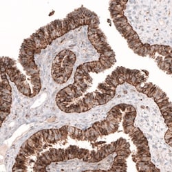 Galectin-3BP/MAC-2BP/LGALS3BP Antibody, Novus Biologicals 0.1mL; Unlabeled:Antibodies,