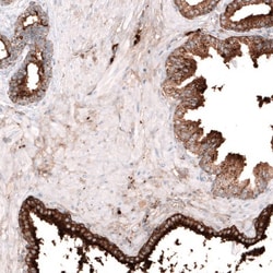 Galectin-3BP/MAC-2BP/LGALS3BP Antibody, Novus Biologicals 0.1mL; Unlabeled:Antibodies,