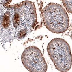 Galectin-3BP/MAC-2BP/LGALS3BP Antibody, Novus Biologicals 0.1mL; Unlabeled:Antibodies,