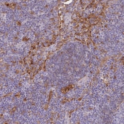 Galectin-9 Antibody, Novus Biologicals 25 &mu;L, Unlabeled:Antibodies,