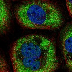 Galectin-9B Antibody, Novus Biologicals:Antibodies:Primary Antibodies