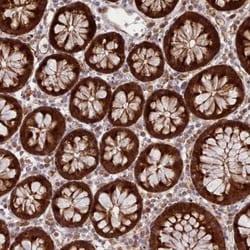 Galectin-9B Antibody, Novus Biologicals:Antibodies:Primary Antibodies