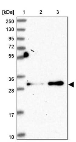Galectin-9B Antibody, Novus Biologicals:Antibodies:Primary Antibodies