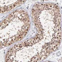 Gankyrin Antibody, Novus Biologicals 25 &mu;L; Unlabeled:Antibodies, Polyclonal