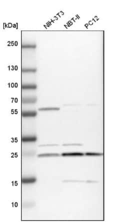 Gankyrin Antibody, Novus Biologicals 25 &mu;L; Unlabeled:Antibodies, Polyclonal