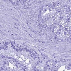 Gastric Lipase Antibody, Novus Biologicals 0.1mL; Unlabeled:Antibodies,