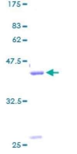 Novus Biologicals Recombinant Human Gastrin-releasing Peptide/Bombesin/Neuromedin C GST (N-Term) Protein 2 &mu;g | Buy Online | Novus Biologicals&trade; | Fisher Scientific