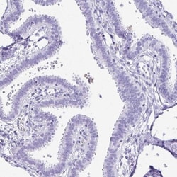 Gastrokine 1 Antibody, Novus Biologicals:Antibodies:Primary Antibodies